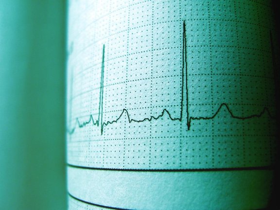 Archivo - Imagen de un electrocardiograma