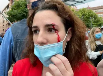 La diputada de Vox Roc&iacute;o de Meer ha resultado herida al recibir una pedrada antes del mitin del partido en Sestao (Vizcaya) - VOX