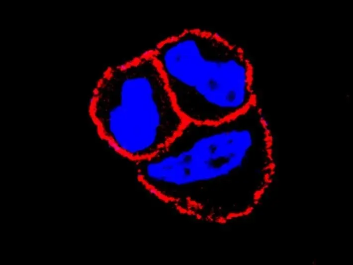 Archivo - El CSIC evidencia que el uso combinado de un nuevo f&aacute;rmaco mejora la eficiencia de algunas terapias de c&aacute;ncer de mama