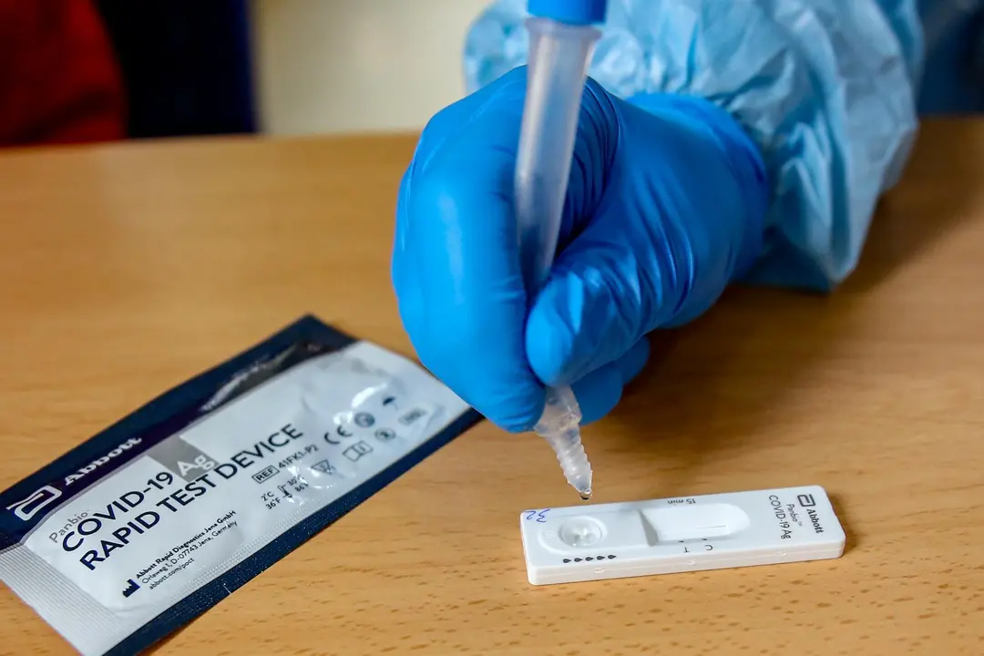 Archivo - Material necesario para la realizaci&oacute;n de test de ant&iacute;genos. Archivo.