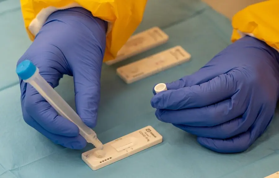 Archivo - Pruebas de coronavirus.