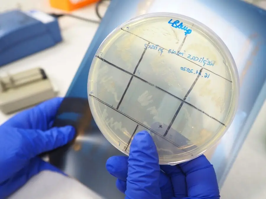 Archivo - Placa de Petri con muestras celulares para la investigaci&oacute;n de la leucemia en el CBM.