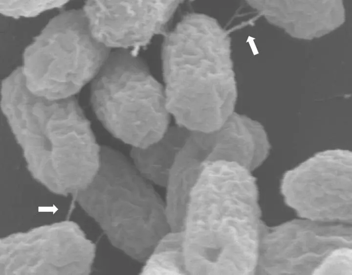 Archivo - Superbacterias atrapadas en el acto de transferir un pl&aacute;smido de resistencia a antibi&oacute;ticos a trav&eacute;s de su "pilus" similar a una jeringa, marcado con flechas.