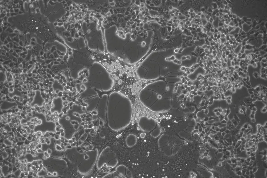 C&eacute;lula infectada con una variante del Virus del Herpes Simplex generada durante el cultivo celular.