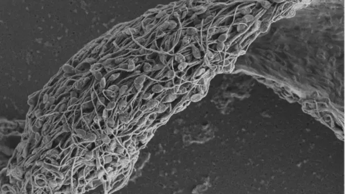 Micrograf&iacute;a electr&oacute;nica de barrido de espermatozoides humanos pegados e inmovilizados por un anticuerpo antiesperm&aacute;tico.