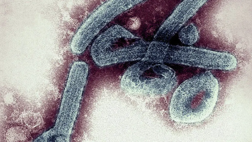 El virus de Marburgo se detect&oacute; por primera vez en la ciudad de Marburgo (Alemania) en 1967