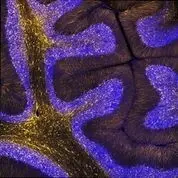 Archivo - Esta imagen muestra una secci&oacute;n delgada tomada del cerebelo de un cerebro de hur&oacute;n adulto, con astrocitos marcados en amarillo y n&uacute;cleos celulares marcados en azul
