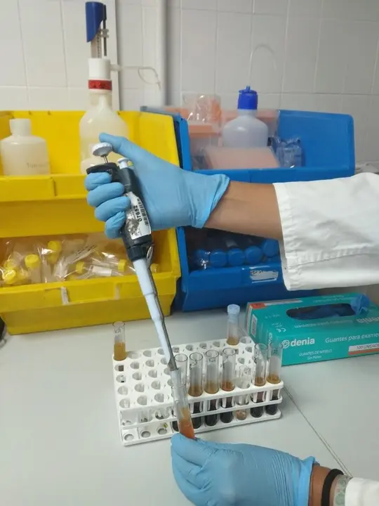 Archivo - Investigaci&oacute;n de cribado de hipercolesterolemia en el Macarena