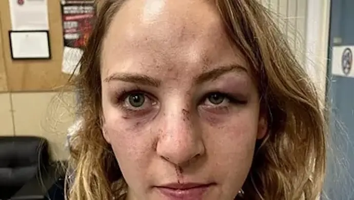 Margaux Pinot, tras la agresi&oacute;n.INSTAGRAM