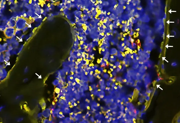 Tratar acn&eacute; con antibi&oacute;ticos sist&eacute;micos puede dificultar la maduraci&oacute;n del esqueleto en la adolescencia, seg&uacute;n un estudio. EP / Archivo