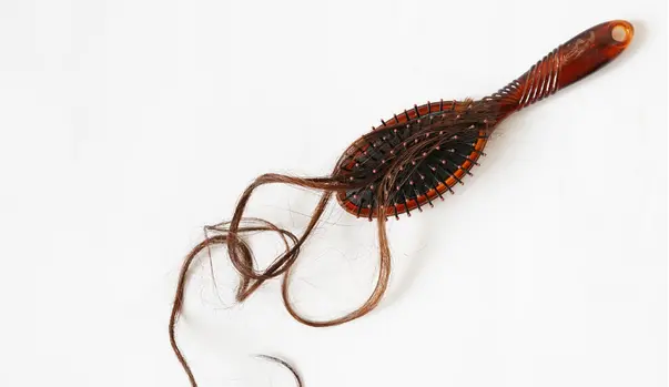 Injertos de Pelo