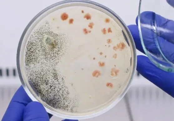 Un m&eacute;dico analizando unas bacterias. / A.S.