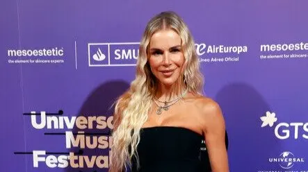La modelo relata su infancia marcada por el bullying. / EP