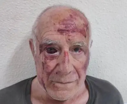 Domingo tras ser agredido en las calles de Torre Pacheco. / X