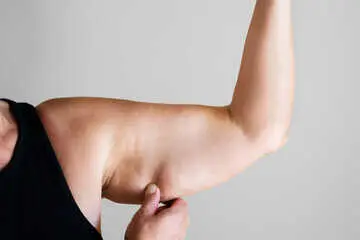 &iquest;Gen&eacute;tica, hormonas o mala rutina? El verdadero culpable de tus brazos fl&aacute;cidos. / A.S.P