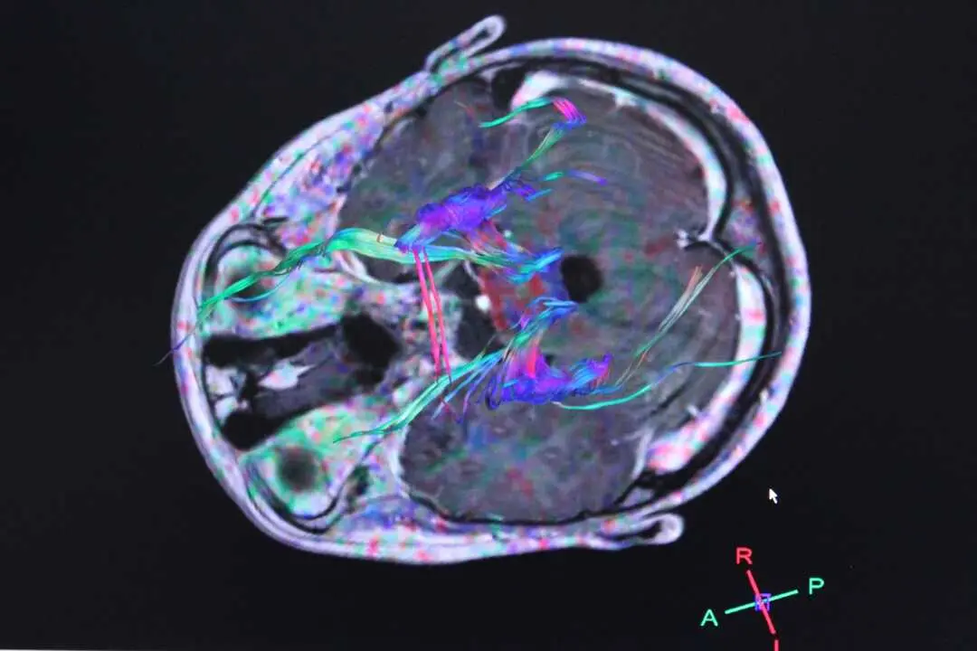 Imagen de archivo de la actividad del cerebro. / EP