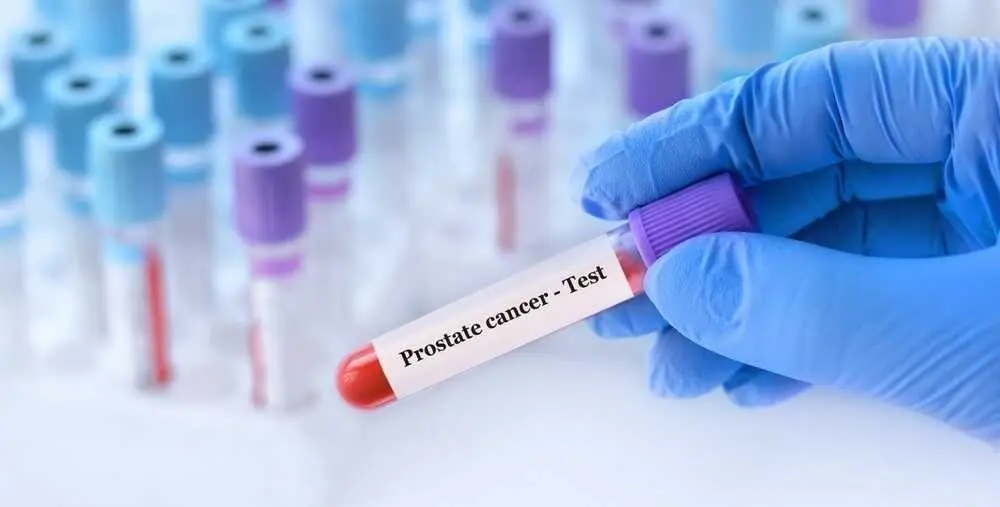 Abogan por el test del c&aacute;ncer de pr&oacute;stata. / EP