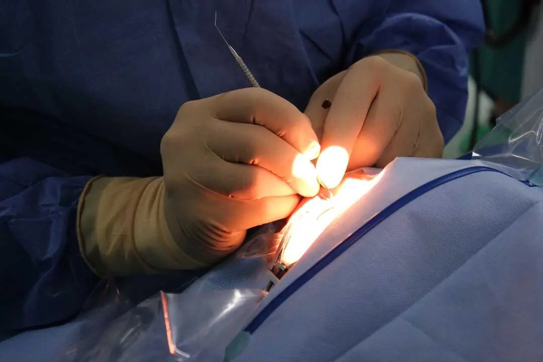 Un m&eacute;dico durante una intervenci&oacute;n quir&uacute;rgica. / EP / Archivo