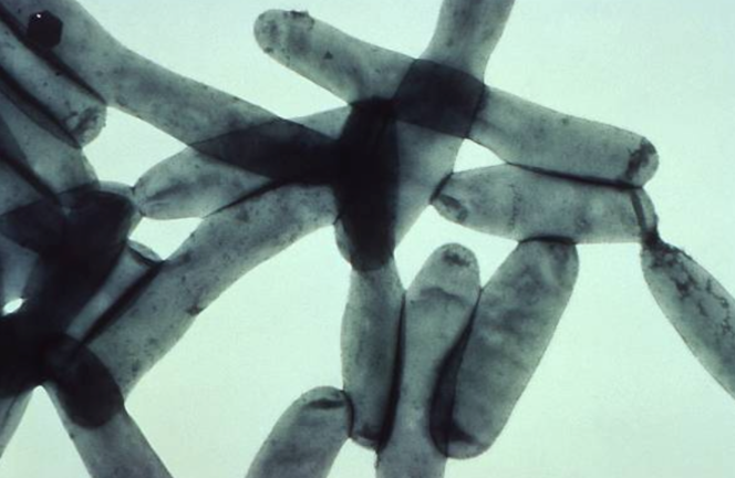 Bacteria de la legionela a través de un microscopio.