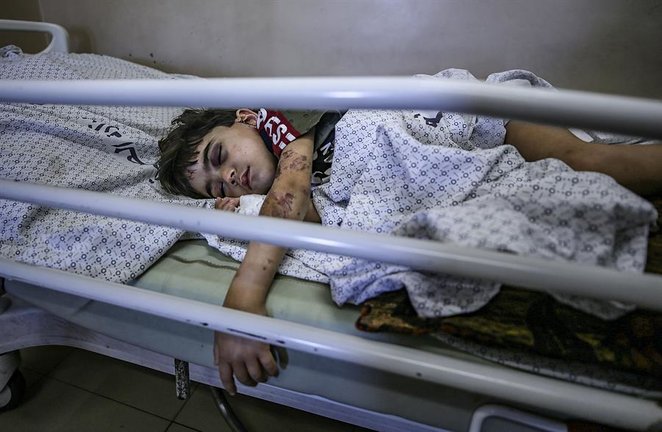 Un niño palestino herido por los ataques aéreos israelíes yace en el hospital Al-Shifa de la ciudad de Gaza, el 18 de mayo de 2021. En respuesta a los días de violentos enfrentamientos entre las fuerzas de seguridad israelíes y los palestinos en Jerusalén, varias facciones militantes palestinas de Gaza lanzaron ataques con cohetes desde el 10 de mayo que mataron al menos a 12 israelíes hasta la fecha. El Ministerio de Sanidad palestino dijo que al menos 213 palestinos, entre ellos 61 niños, murieron en los ataques aéreos israelíes de represalia. (Atentado, Estados Unidos, Jerusalén) EFE/EPA/HAITHAM IMAD

Traducción realizada con la versión gratuita del traductor www.DeepL.com/Translator