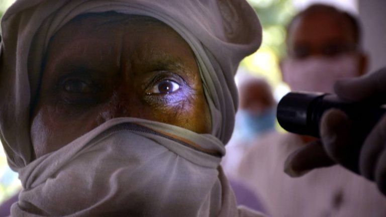 En la India una inesperada secuela del coronavirus SARS-CoV-2 mantiene en alerta a las autoridades sanitarias. Se trata del hongo negro Mucormicosis