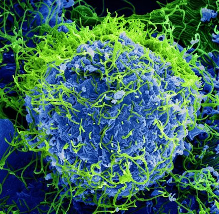 Archivo - Micrografía electrónica de barrido coloreada de partículas del virus del Ébola (verde) que brotan y se adhieren a la superficie de las células.