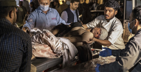 El personal sanitario traslada a un herido tras los ataques. / REUTRES