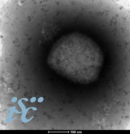 Imagen microscópica del virus causante de la viruela del mono, cuya secuenciación completa han logrado investigadores del Instituto de Salud Carlos III. Fotografía cedida por el Instituto de Salud Carlos III. EFE