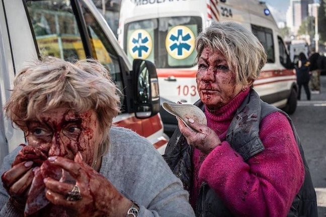 Dos ucranianas heridas tras los ataques indiscriminados de Putin en Kiev.