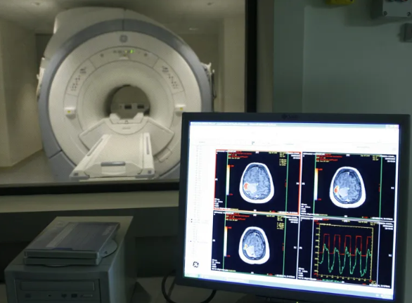 Vista de un escáner en un centro de tratamiento de Alzheimer. EFE/Sergio Barrenechea
