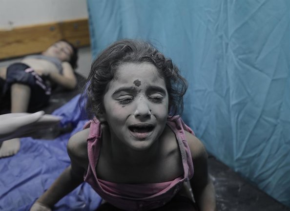 Niños palestinos heridos en un bombardeo israelí reciben tratamiento en un hospital de Khan Younis, en el sur de la Franja de Gaza, 17 de octubre de 2023.  EFE/EPA/HAITHAM IMAD