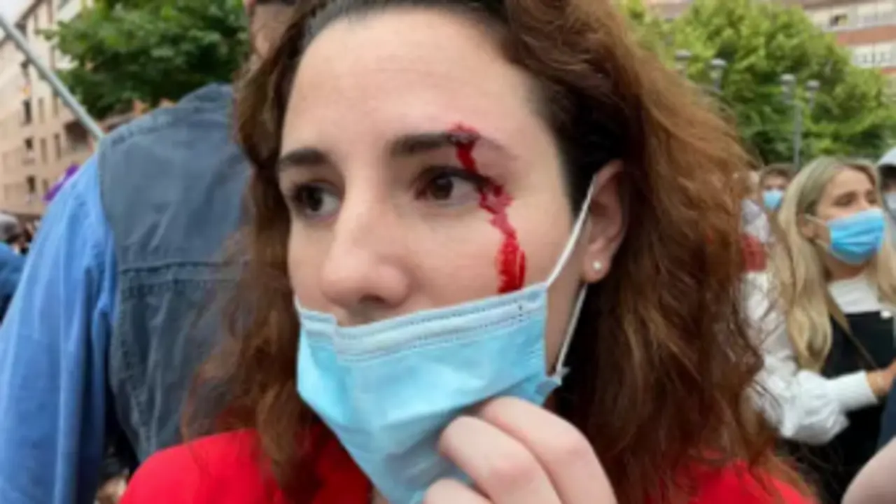 La diputada de Vox Roc&iacute;o de Meer ha resultado herida al recibir una pedrada antes del mitin del partido en Sestao (Vizcaya) - VOX