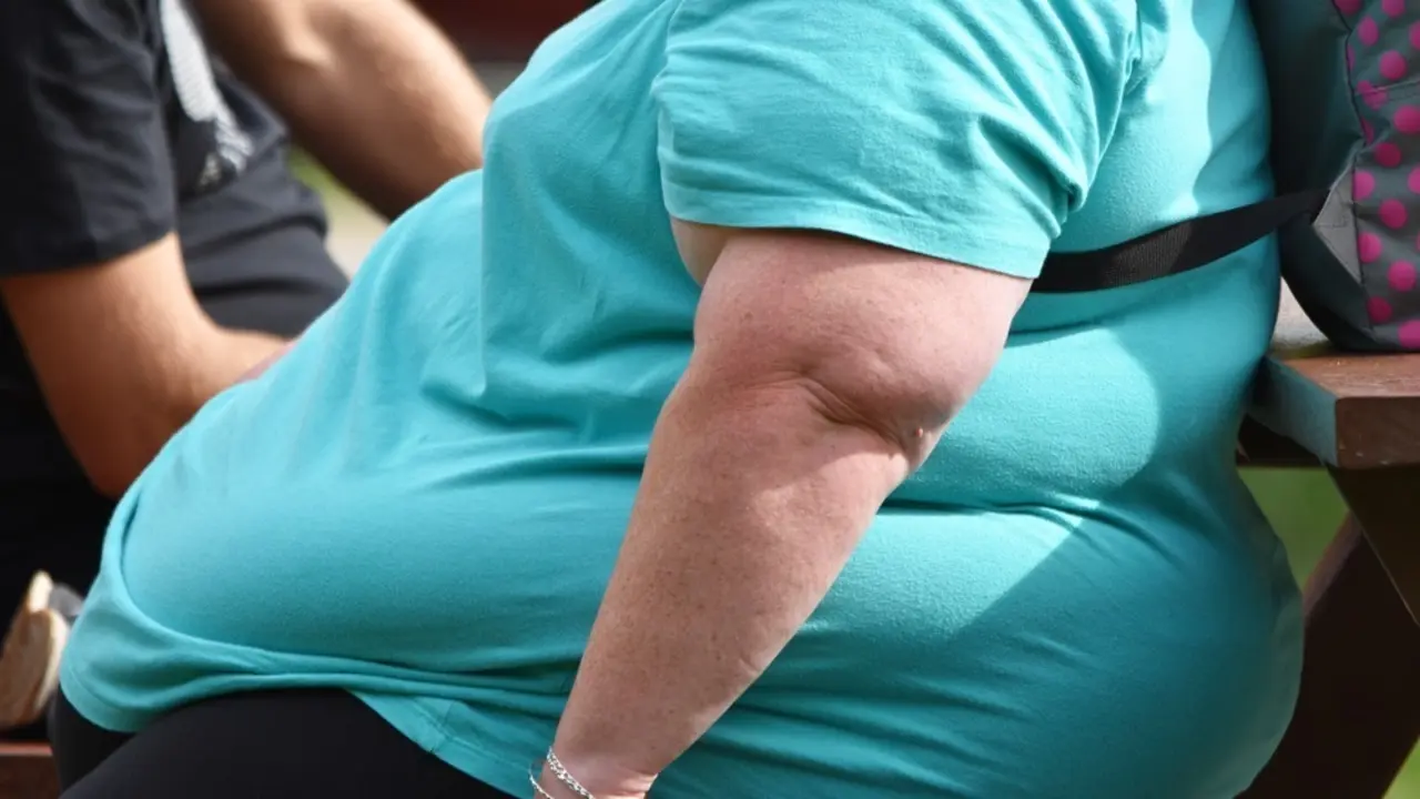 Persona con obesidad