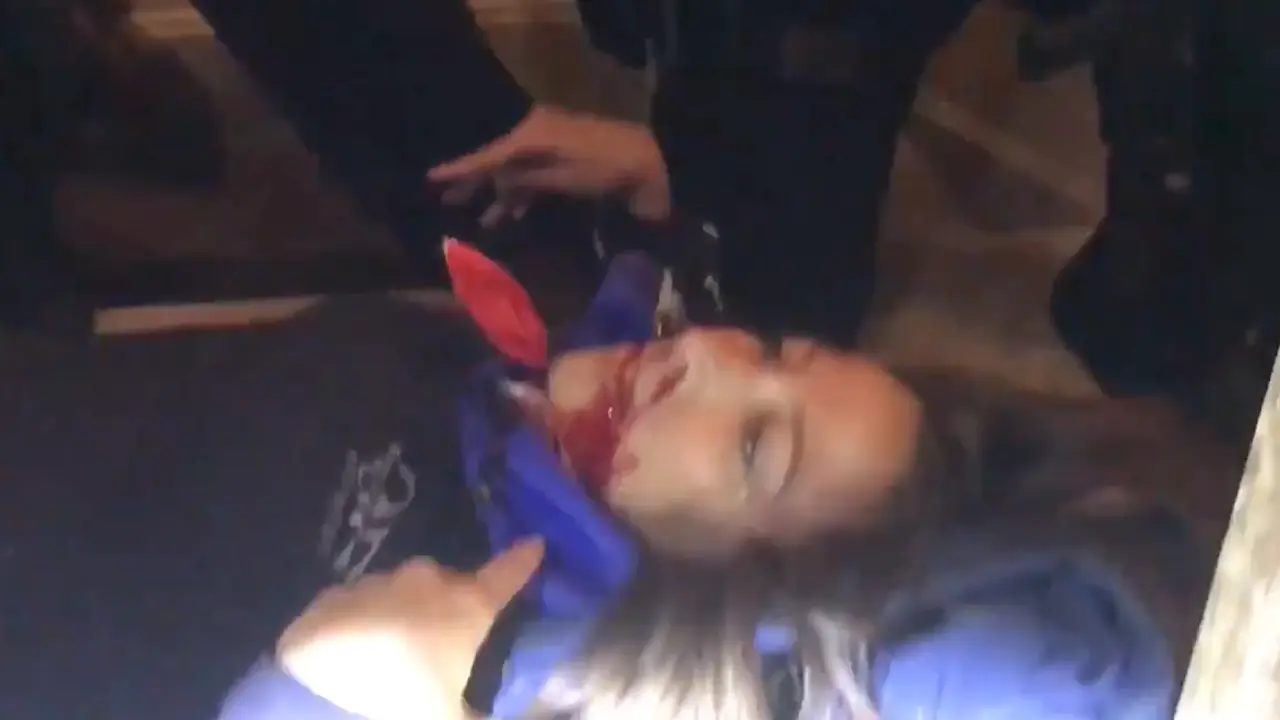 La mujer herida de bala en el Capitolio.