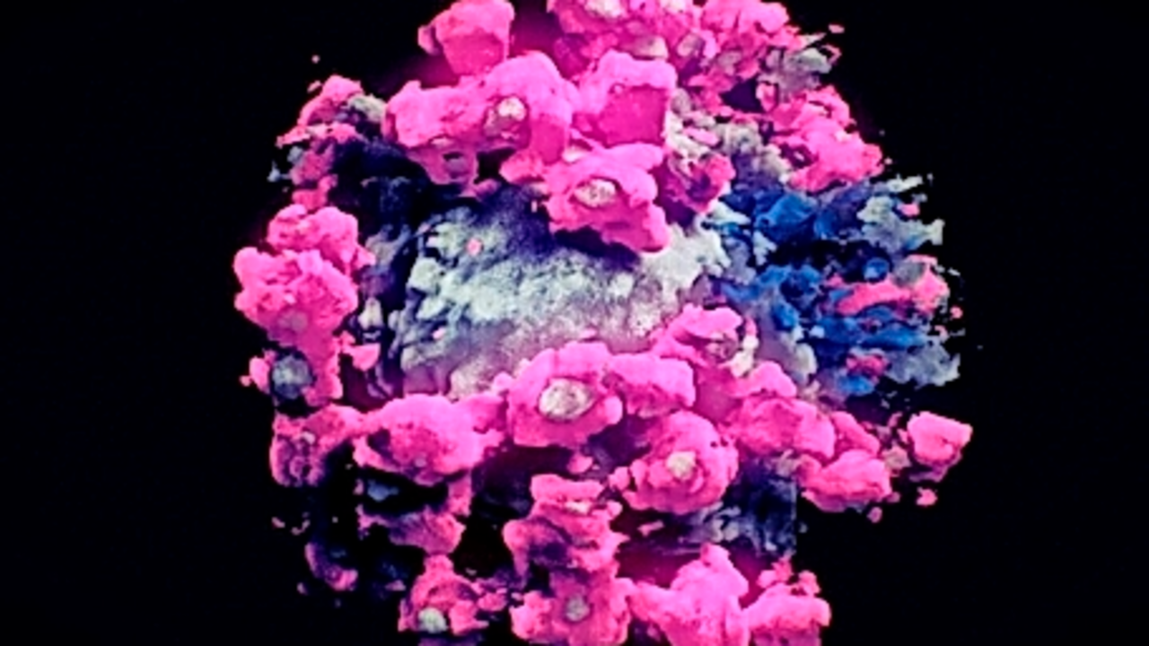 No es una foto (no se puede fotografiar a un virus), pero tampoco en un modelo de ordenador.
Lo que un equipo de investigadores en tres pa&iacute;ses
ha logrado es la primera imagen real y en tres dimensiones del SARS-CoV-2, un avance que puede ayudar a los cient&iacute;ficos a luchar contra &eacute;l.