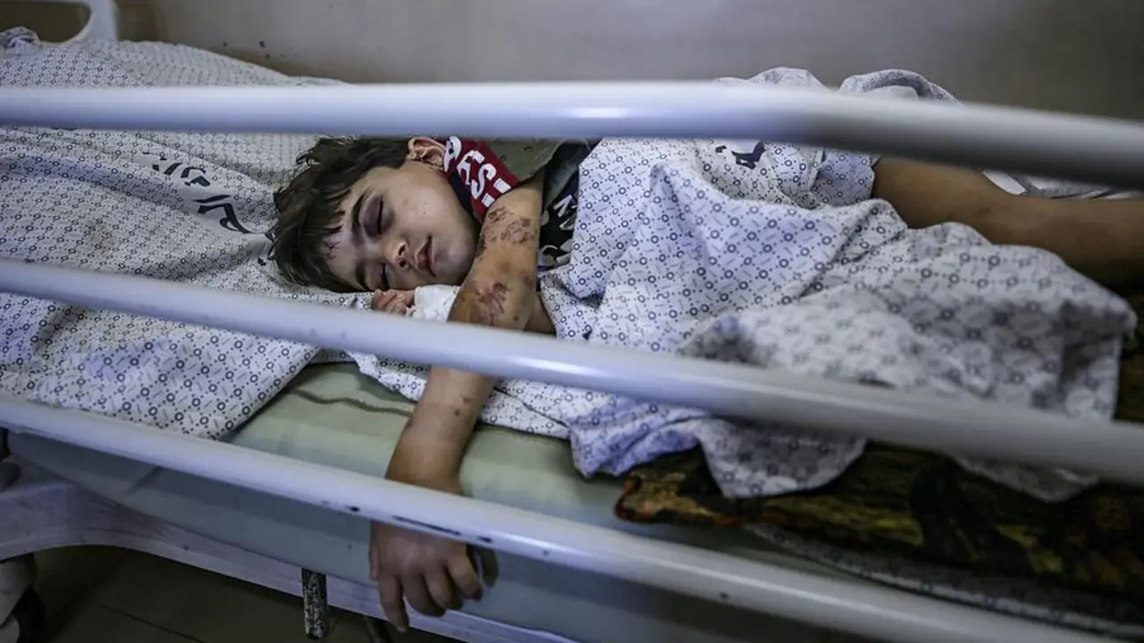 Un ni&ntilde;o palestino herido por los ataques a&eacute;reos israel&iacute;es yace en el hospital Al-Shifa de la ciudad de Gaza, el 18 de mayo de 2021. En respuesta a los d&iacute;as de violentos enfrentamientos entre las fuerzas de seguridad israel&iacute;es y los palestinos en Jerusal&eacute;n, varias facciones militantes palestinas de Gaza lanzaron ataques con cohetes desde el 10 de mayo que mataron al menos a 12 israel&iacute;es hasta la fecha. El Ministerio de Sanidad palestino dijo que al menos 213 palestinos, entre ellos 61 ni&ntilde;os, murieron en los ataques a&eacute;reos israel&iacute;es de represalia. (Atentado, Estados Unidos, Jerusal&eacute;n) EFE/EPA/HAITHAM IMAD

Traducci&oacute;n realizada con la versi&oacute;n gratuita del traductor www.DeepL.com/Translator