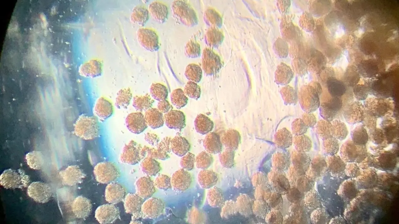 Microtejidos durante su recolecci&oacute;n observados al microscopio.