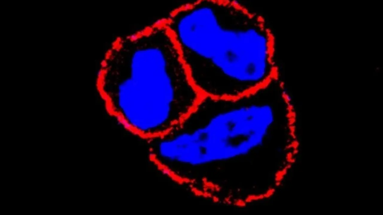 Archivo - El CSIC evidencia que el uso combinado de un nuevo f&aacute;rmaco mejora la eficiencia de algunas terapias de c&aacute;ncer de mama
