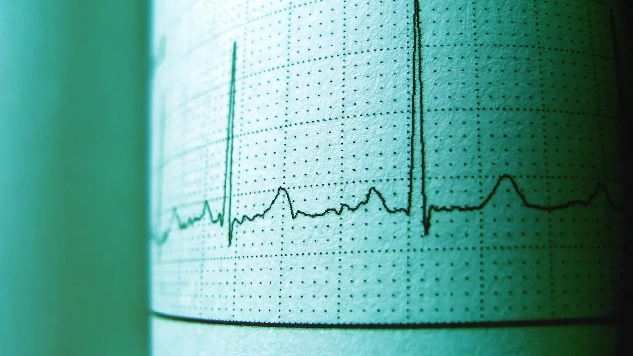 Archivo - Imagen de un electrocardiograma
