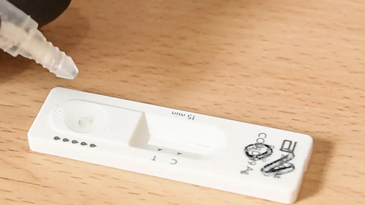 Archivo - Material necesario para la realizaci&oacute;n de test de ant&iacute;genos. 