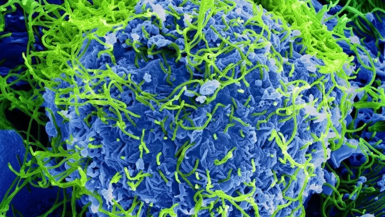 Archivo - Micrograf&iacute;a electr&oacute;nica de barrido coloreada de part&iacute;culas del virus del &Eacute;bola (verde) que brotan y se adhieren a la superficie de las c&eacute;lulas.