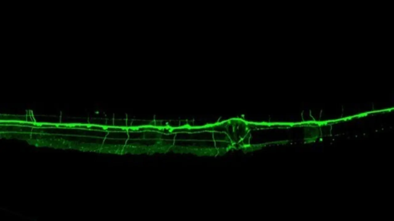Fotograf&iacute;a de un animal C. Elegans transg&eacute;nico que expresa la prote&iacute;na de fluorescencia GFP en el sistema nervioso.