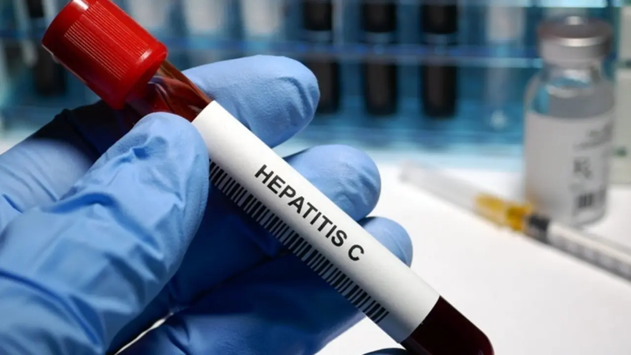 Archivo - Hepatitis C treatment  Hepatitis C - sexually transmitted disease blood test and treatment