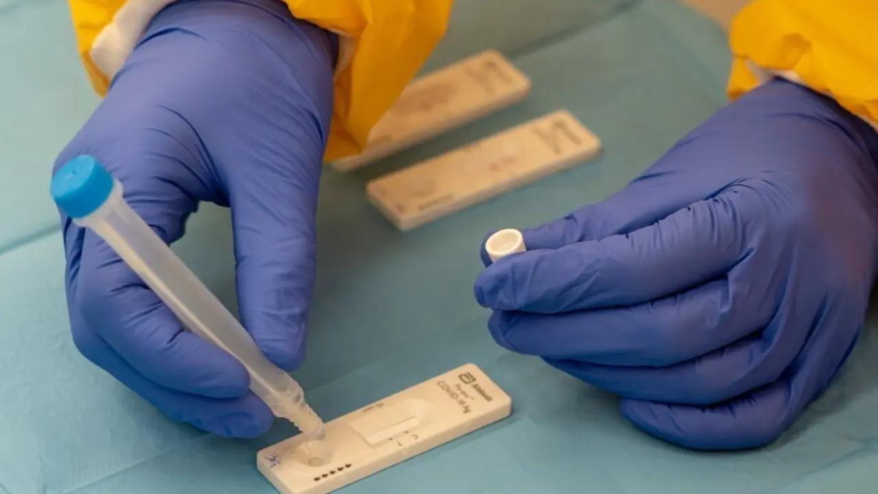 Archivo - Pruebas de coronavirus.
