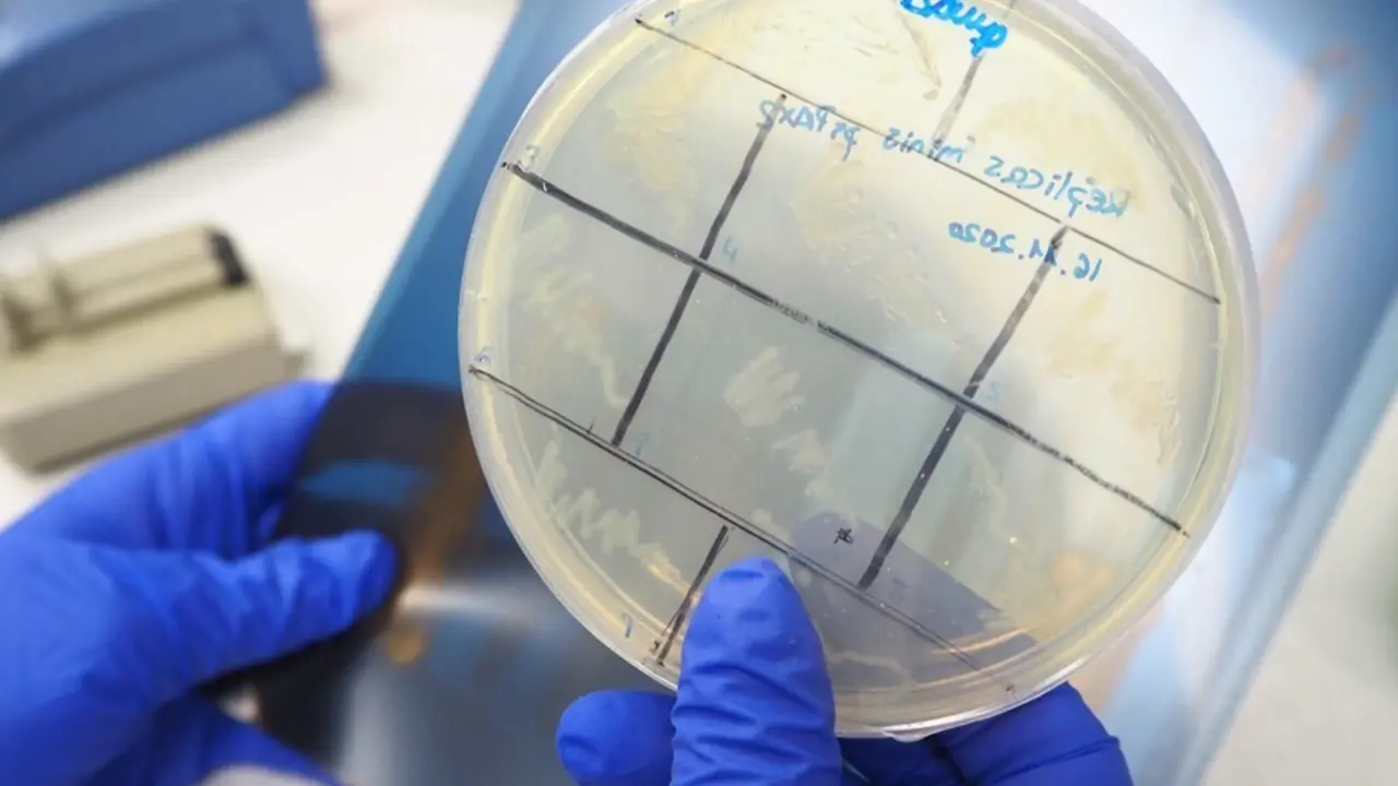 Archivo - Placa de Petri con muestras celulares para la investigaci&oacute;n de la leucemia en el CBM.