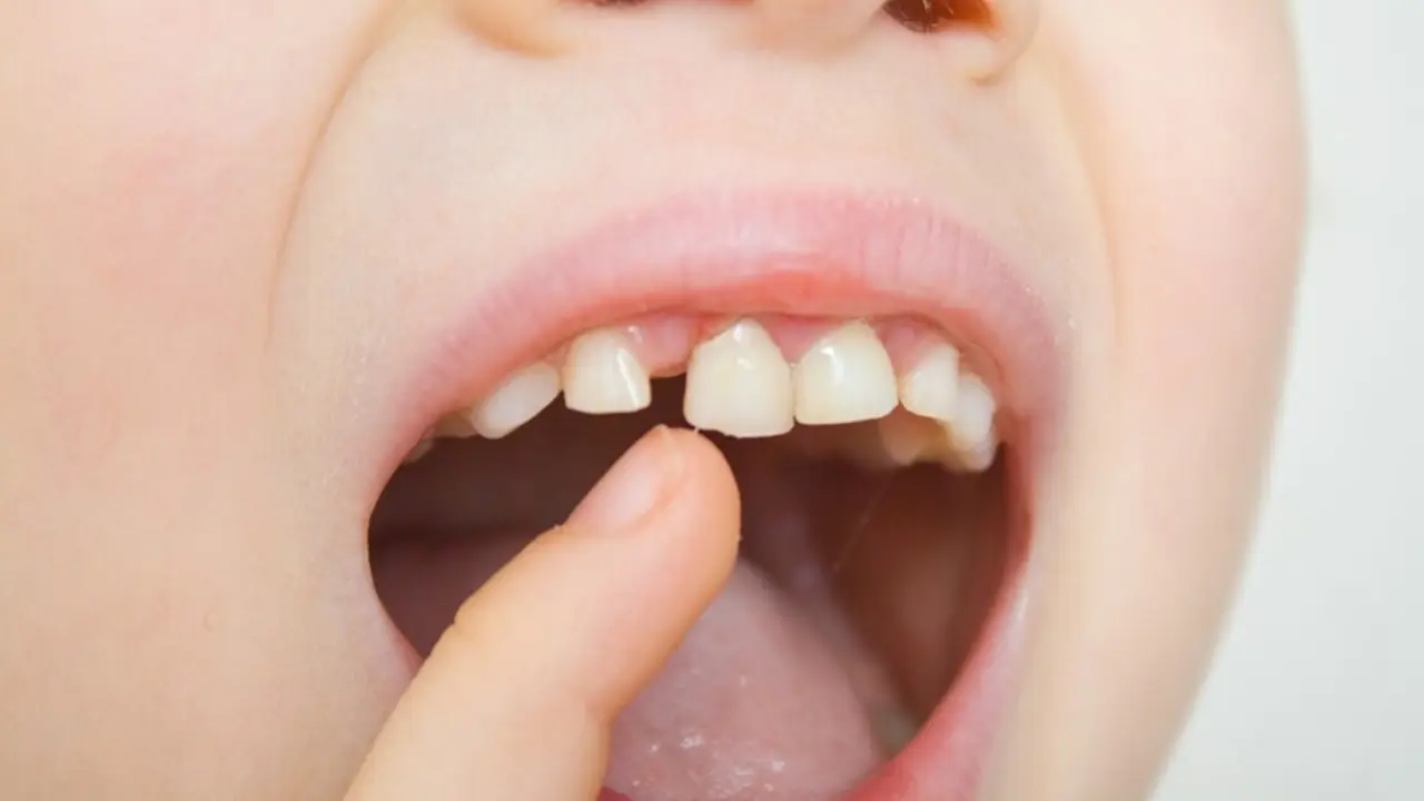 Archivo - Dientes de leche, dientes de ni&ntilde;o, boca de ni&ntilde;o