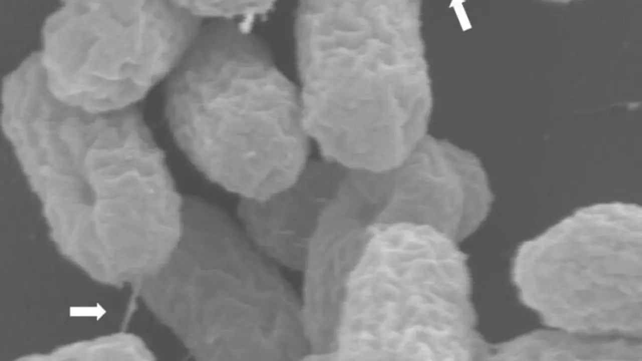 Archivo - Superbacterias atrapadas en el acto de transferir un pl&aacute;smido de resistencia a antibi&oacute;ticos a trav&eacute;s de su "pilus" similar a una jeringa, marcado con flechas.