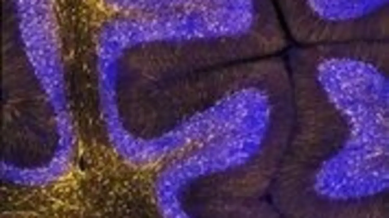 Archivo - Esta imagen muestra una secci&oacute;n delgada tomada del cerebelo de un cerebro de hur&oacute;n adulto, con astrocitos marcados en amarillo y n&uacute;cleos celulares marcados en azul