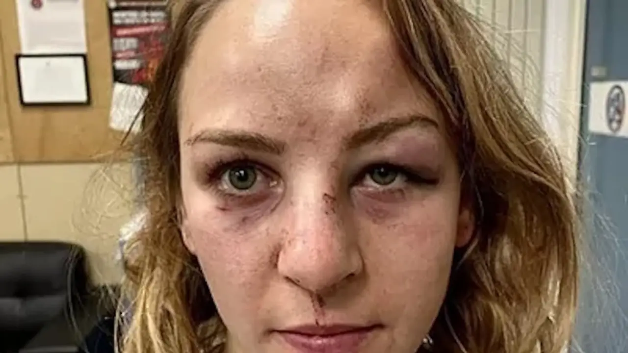 Margaux Pinot, tras la agresi&oacute;n.INSTAGRAM