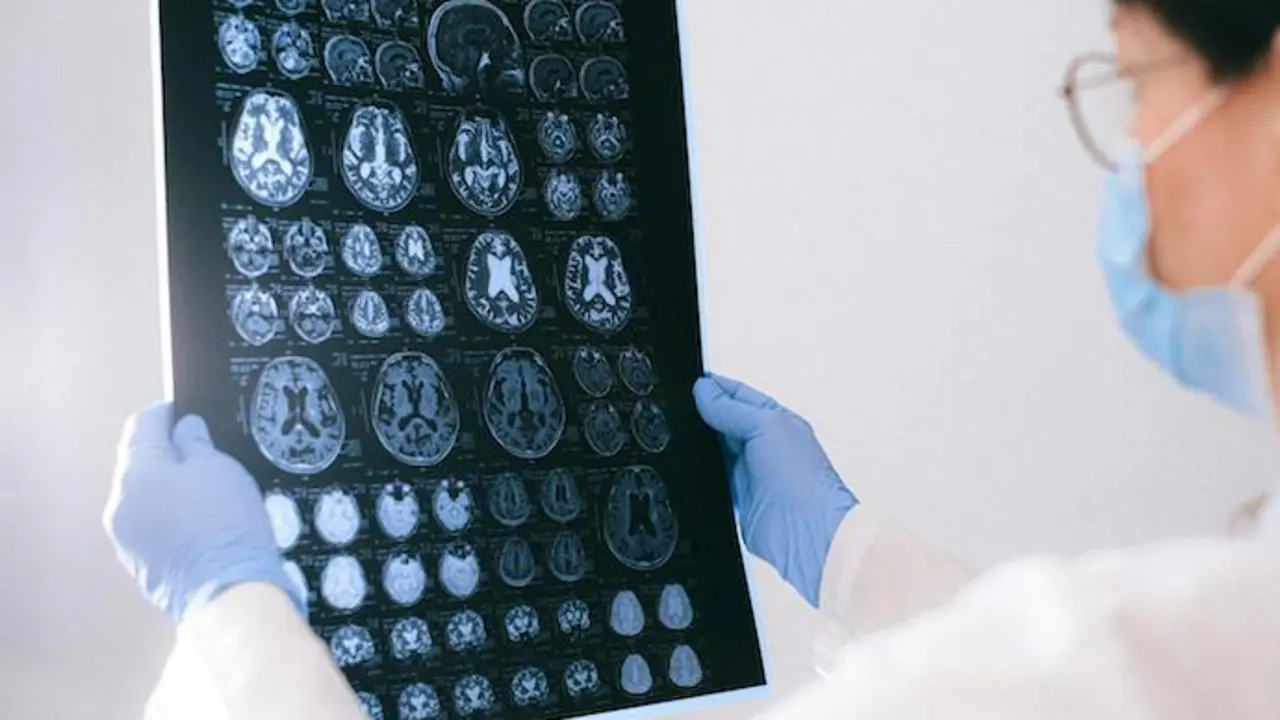Un an&aacute;lisis de sangre podr&iacute;a identificar y tratar la enfermedad en etapas m&aacute;s tempranas. / A.E